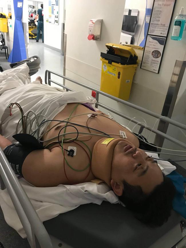 Motorcyclist Henry Sun was seriously injured when he was struck by a car in Enoggera. Picture: Supplied