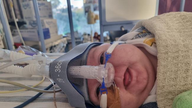 During his 260 days in NICU Warwick Atticus Nation was intubated and extubated, had an NG tube and tracheostomy, and used a CPAP machine and JET machine to stay alive.