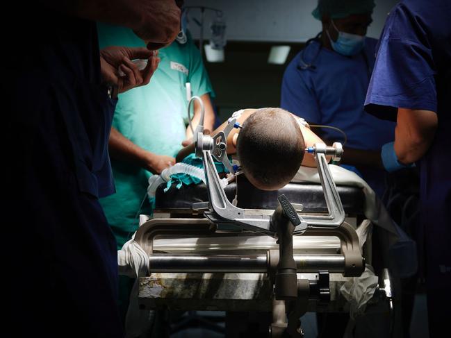 A boy undergoes surgery in PNG thanks to the selfless Australian doctors and nurses working abroad. Picture: Supplied