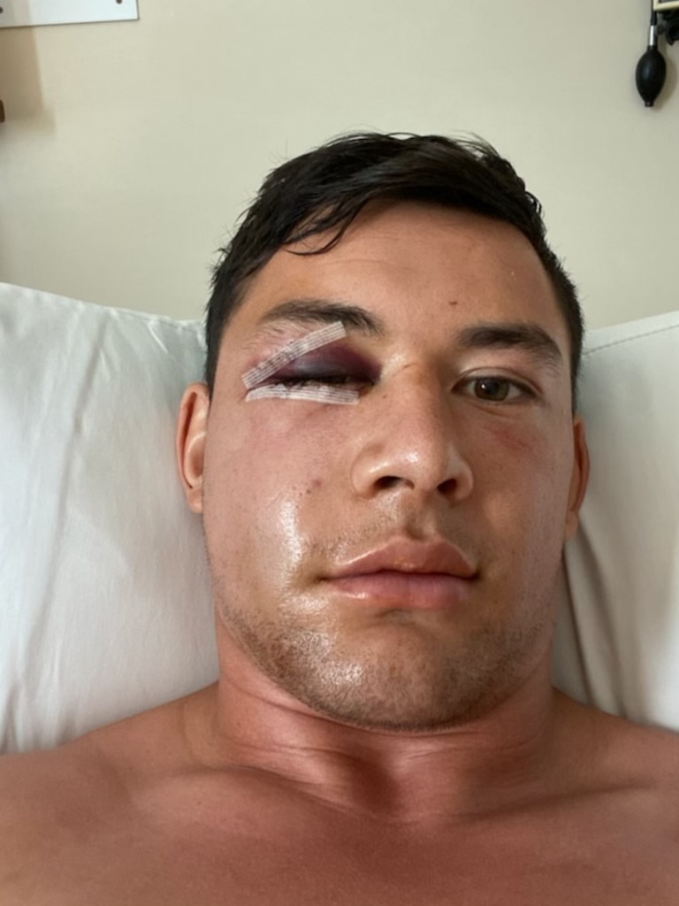 Joey Manu after surgery.