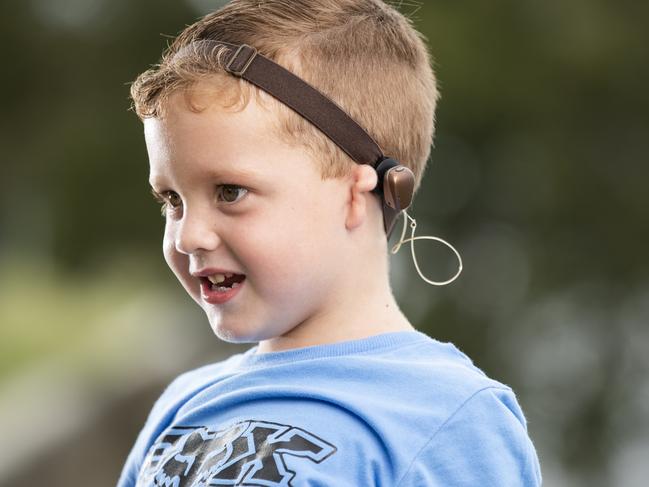 4 year old Hudson Magee who was born with bilateral microtia atresia and wears a bone conductor hearing aid to be able to hear. Photo Lachie Millard