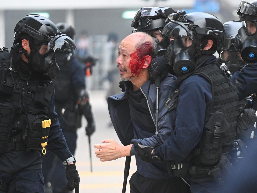 Police detain an injured man after they dispersed a crowd gathered for the 'universal siege on communists' rally at Chater Garden in Hong Kong. Picture: AFP