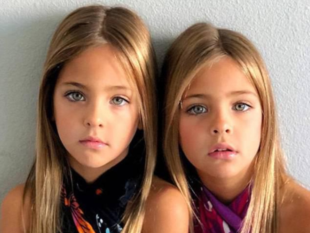 are identical twins and have been called the most beautiful girls in the wo...