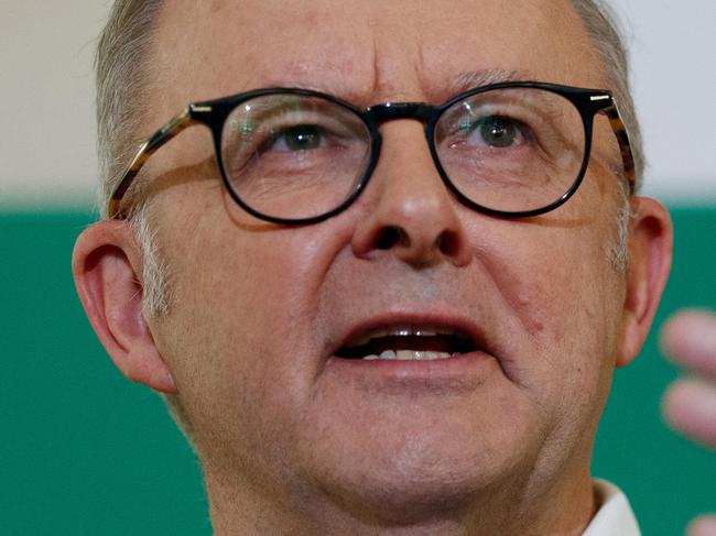 Prime Minister Anthony Albanese during a visit to the Westmead Medicare Urgent Care Clinic in Sydney on Sunday, March 2, 2025. Picture: Nikki Short