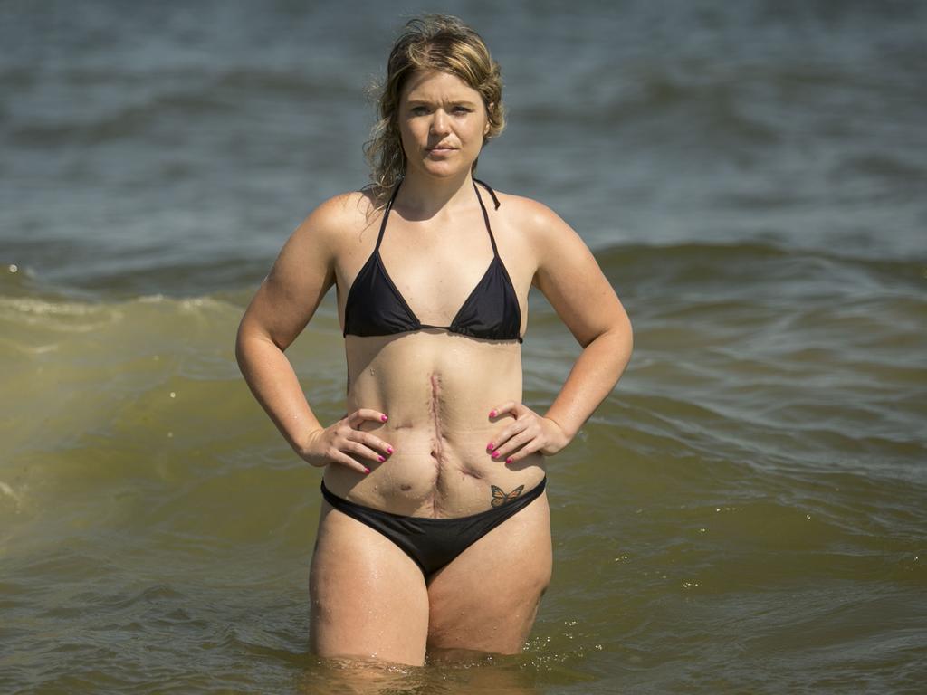 Tessa has spoken about how her life changed after the jet ski accident. Picture: Zandy Mangold