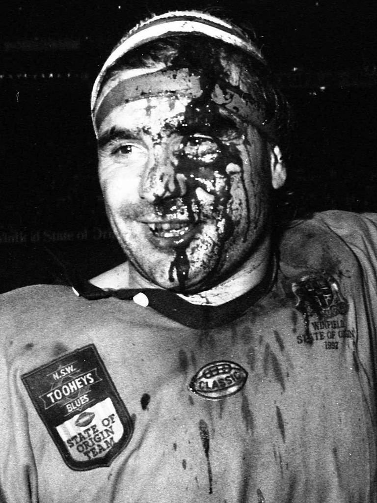 Ben Elias after the incident. Picture: Geoff McLachlan