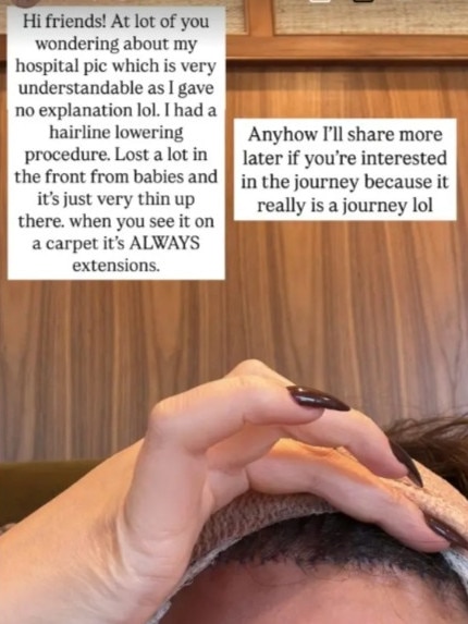 Teigen gives more details of the unusual procedure.