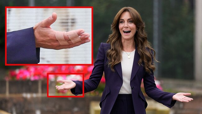 Princess Catherine visiting a prison with hand injury.