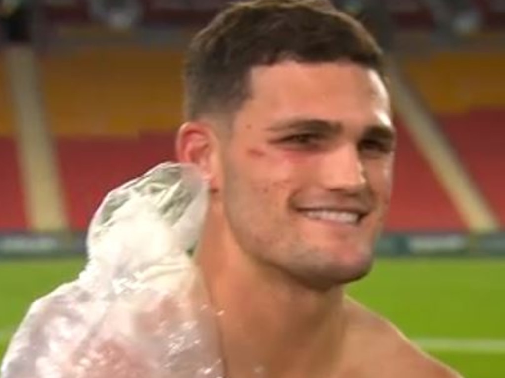 Nathan Cleary Shoulder Injury Blues Star Faces Real Chance Of Reinjury Daily Telegraph