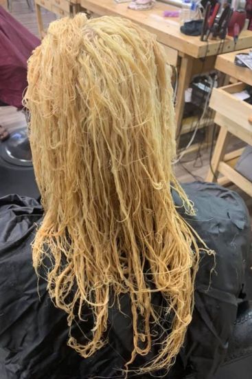 Mum S Bleaching Disaster Left Her Hair Melted To Her Scalp Photo