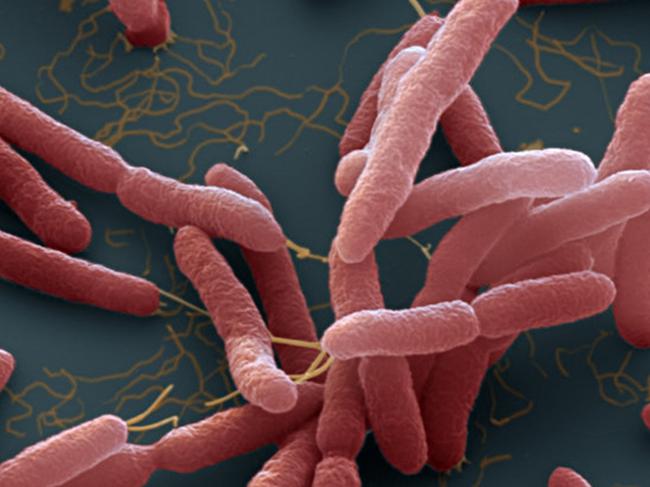 Burkholderia pseudomallei. A bacteria which cause melioidosis, a  disease spread through contaminated water and soil.