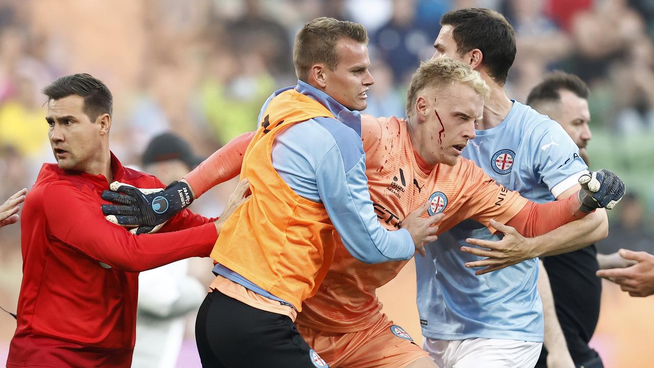 A bleeding Tom Glover of Melbourne City is escorted from the pitch by teammates after fans stormed the field at AAMI Park. Picture: Darrian Traynor / Getty Images