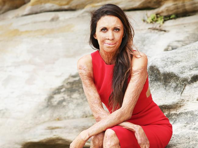 Turia Pitt is one of Australia’s most admired and widely recognised people. Picture Rohan Kelly.