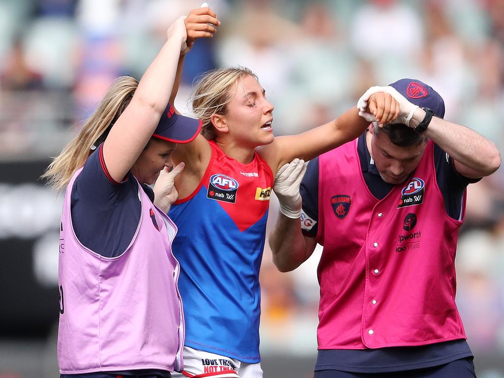 There are calls for further research on women and concussion. Picture: Getty Images