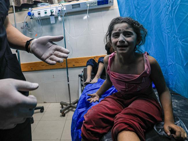 A Palestinian child injured in an Israeli air strike receives treatment at the Nasser Hospital in Khan Yunis in the southern Gaza Strip. Picture: Mahmud Hams/ AFP