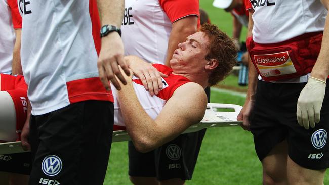 Gary Rohan is stretchered off the SCG after suffering a badly broken leg.