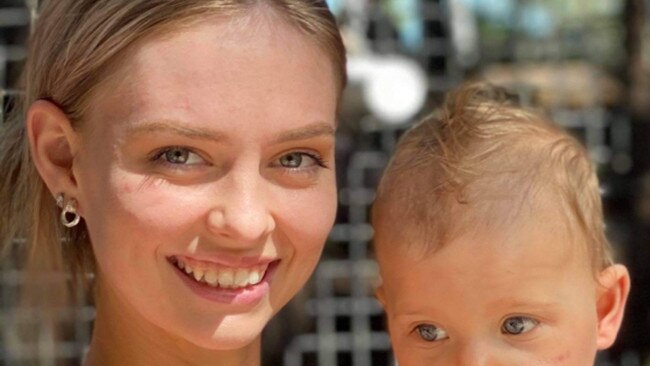 A GoFundMe page has been set up to support Brooke's family during her cancer surgery