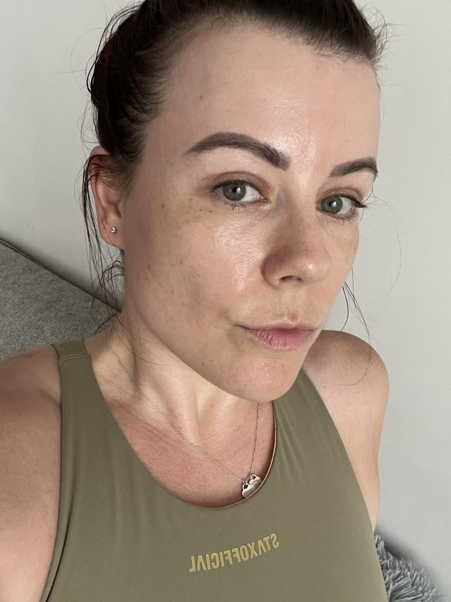 My skin before the challenge was dull and had redness across the nose. Picture: Rebekah Scanlan