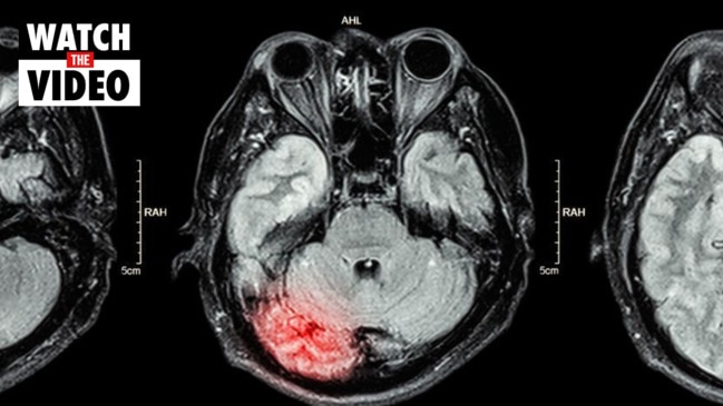 ‘Silent killer’: Worrying Covid effect found