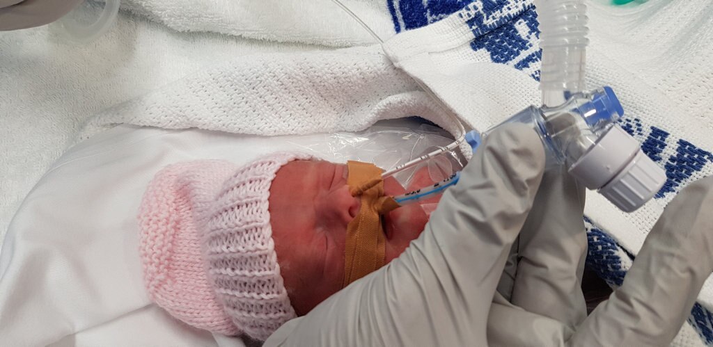 Toowoomba baby Alessandra Nelligan-Cooke was born premature to disability advocate Alyce Nelligan and her fiance Brendan Cooke on July 25, 2018. Picture: Brendan Cooke