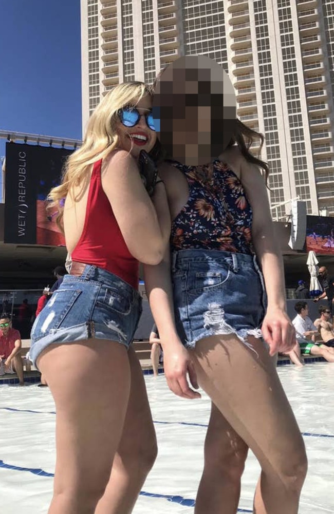 She wore these denim shorts on an 8-hour date, but the friction caused her skin to cut which got infected. Picture: TikTok/imtoooldtobeonthis