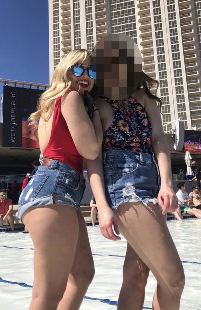 She wore these denim shorts on an 8-hour date, but the friction caused her skin to cut which got infected. Picture: TikTok/imtoooldtobeonthis