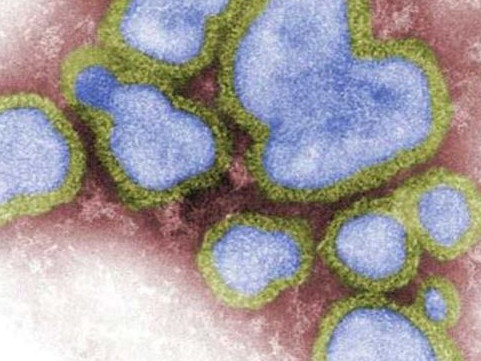 Concerning detail in ‘severe’ flu season