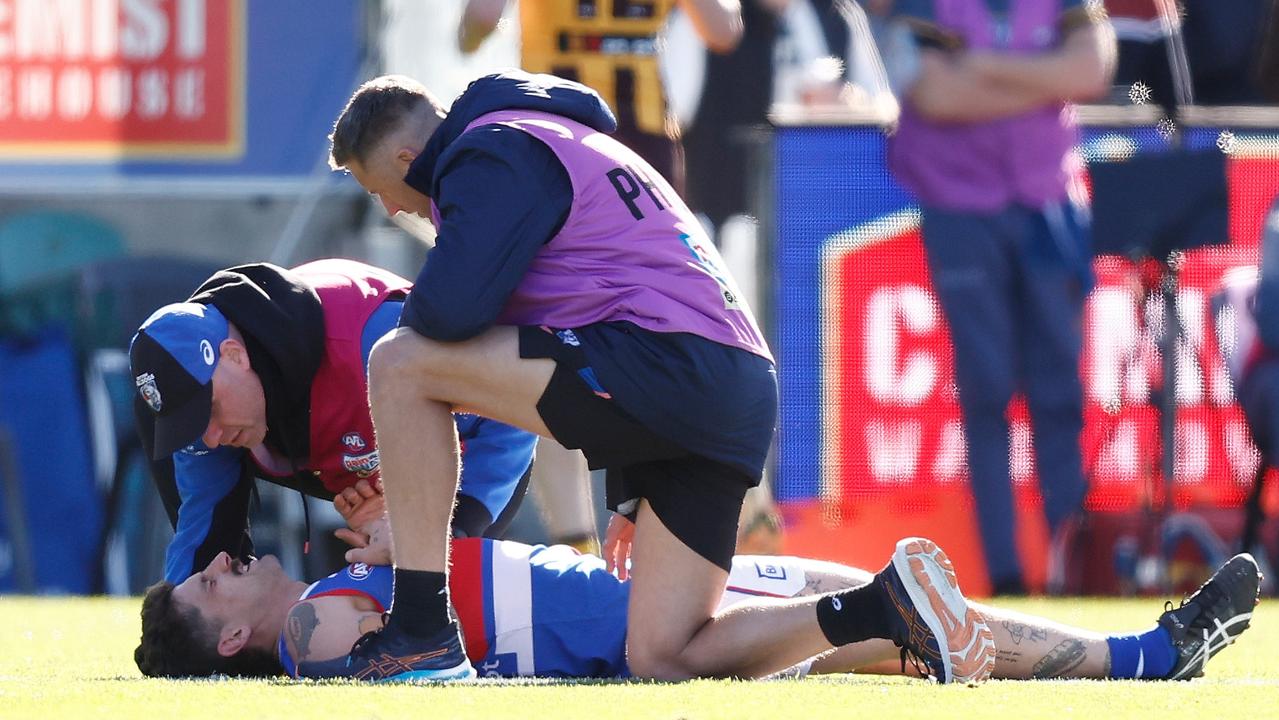 Tom Liberatore of the Bulldogs was subbed out after a knee to the head. Picture: Getty Images