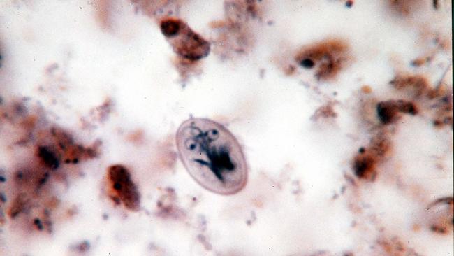Microscopic parasite giardia lamblia that causes giardiasis disease, which was found in Sydney's drinking water previously. Picture: Supplied