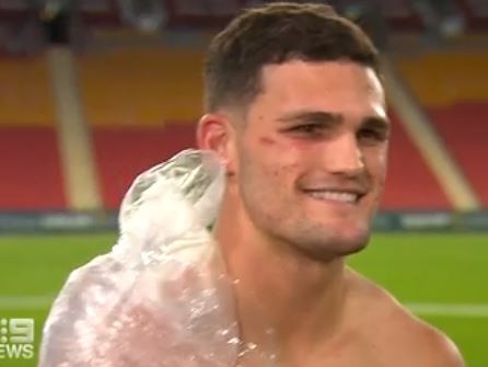 Nathan Cleary with shoulder iced in post-match Origin II presser