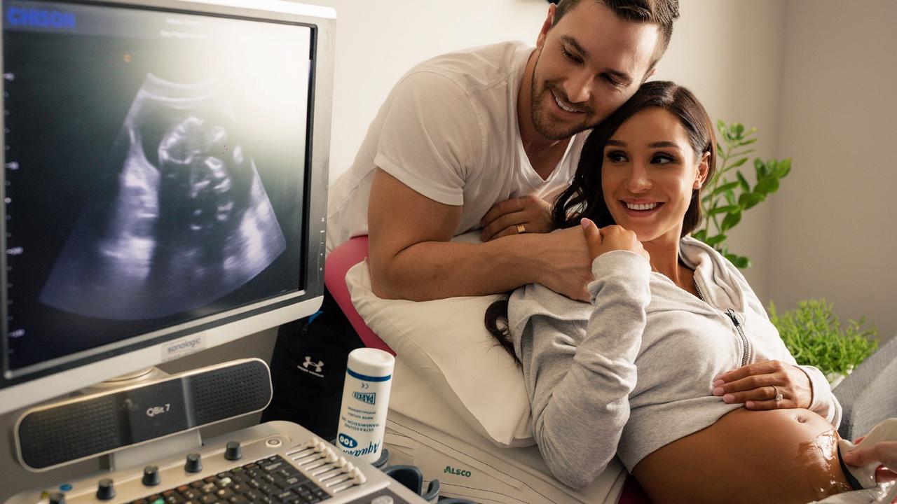 Itsines and fiance Tobi Pearce are expecting their baby in May.