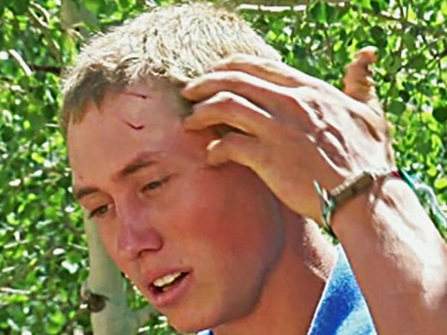 This still frame from video provided by KMGH-TV shows a teen staffer at a Colorado camp, who gave only his first name, Dylan, describing how he fought off a bear after waking up to find the animal biting his head and trying to drag him away at the camp near Ward, Colo., Sunday, July 9, 2017. The 19-year-old was awakened around 4 a.m. to a "crunching sound" with his head inside the mouth of the bear, which was trying to pull him out of his sleeping bag as he slept outside at the camp 48 miles (77 kilometers) northwest of Denver. (KMGH-TV via AP)