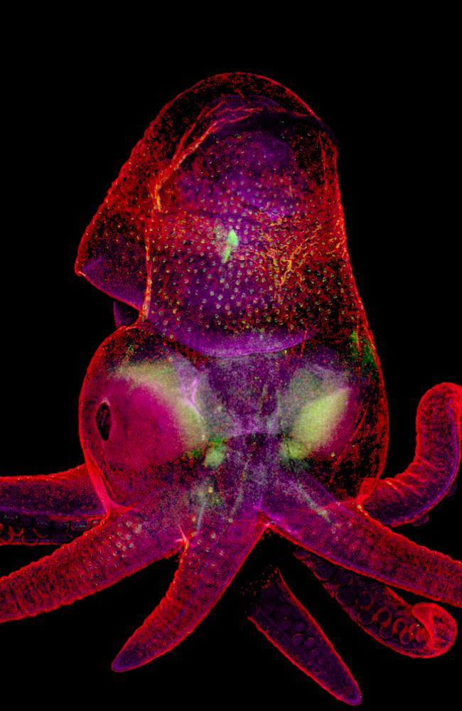 Nikon Small World 2019 19th Place - Octopus bimaculoides embryo Martyna Lukoseviciute Dr. Carrie Albertin, University of Oxford Weatherall Institute of Molecular Medicine Oxford, Oxfordshire, United Kingdom