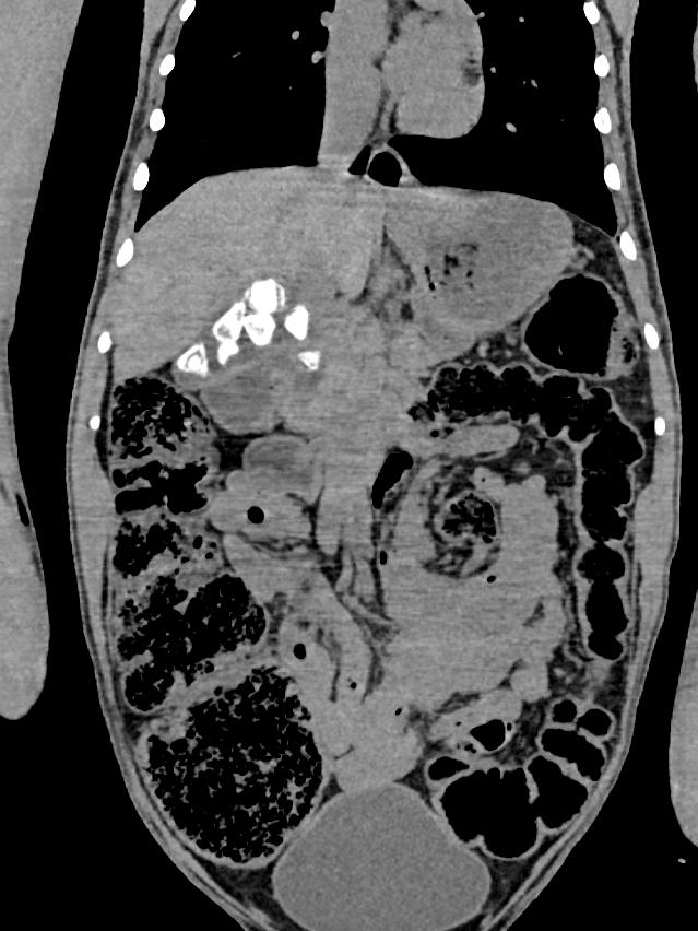 X-ray showing Puspa’s gallstones. Picture: ZoosSA