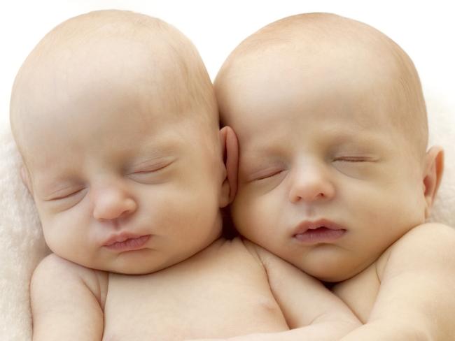 A third type of twin has been identified by researchers, scientifically known as sesquizygotic, or “semi-identical” twins. Scientists believe they develop from a single egg, simultaneously fertilised by two sperm, before dividing. (File picture)