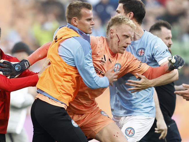 The violent scenes at AAMI Park left Melbourne City goal keeper Tom Glover injured. Picture: Getty