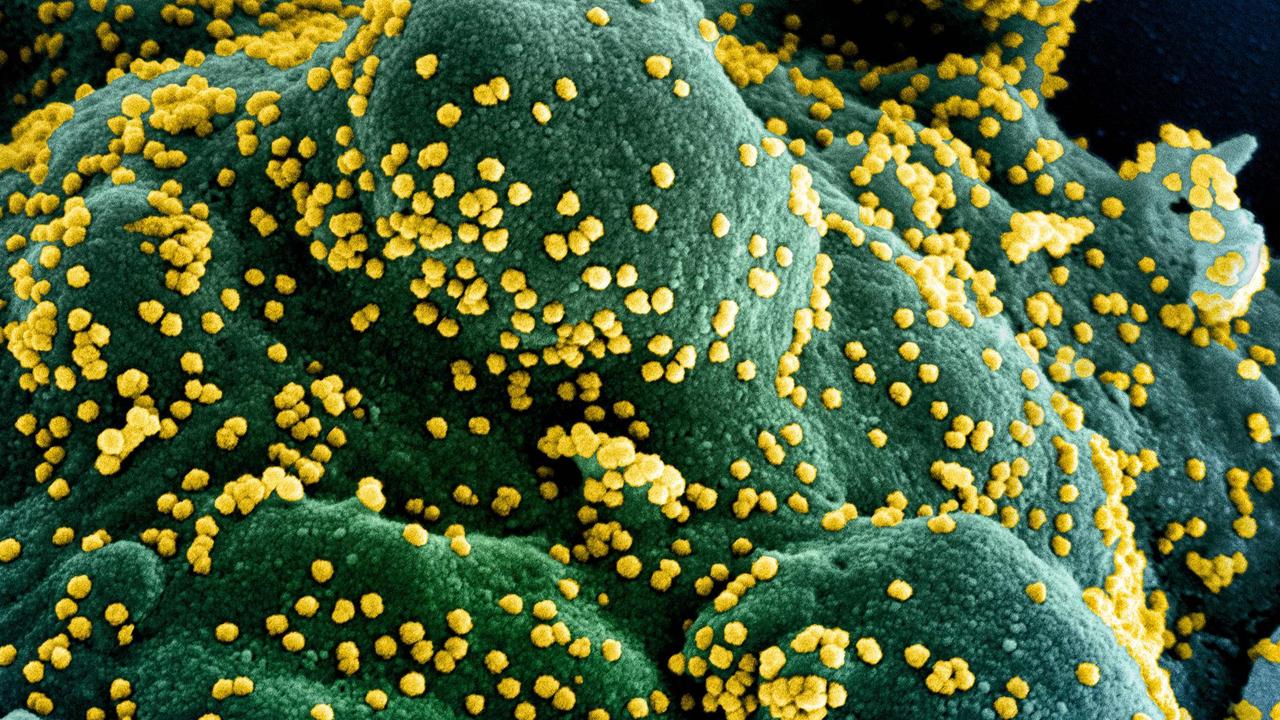 Concern as new Covid variant spreads