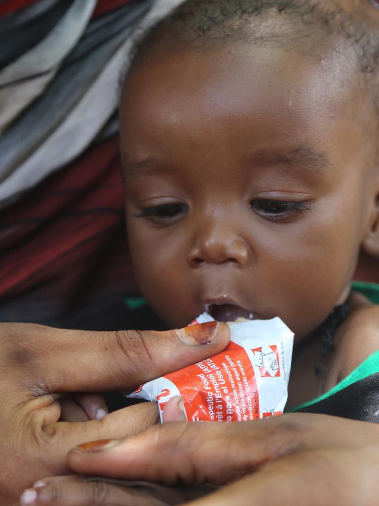 Manahil feeds her six-months-old son Baraa with ready-to-use-therapeutic food at home in Damazine, Blue Nile state. Picture: UNICEF