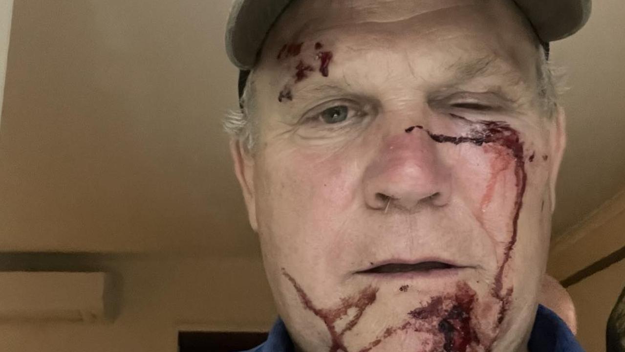 Former MP’s assault charges expected to go to joint trial