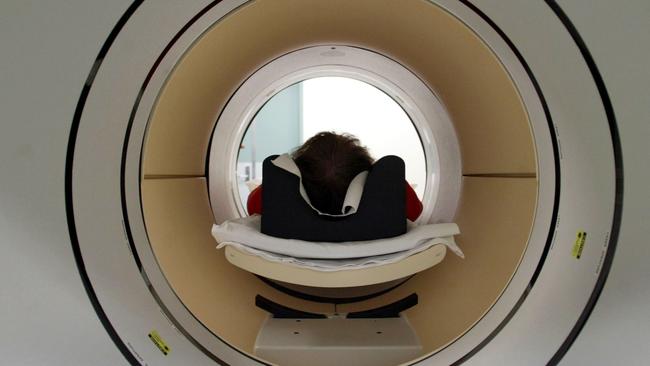 An Alzheimer's sufferer undergoes a scan.