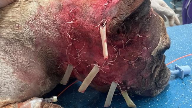 Multiple sutures were put in place after the attack. Picture: Supplied