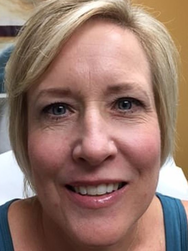 Tracy had surgery to remove the affected area above her lip and has since been declared cancer-free. Picture: KABC 7