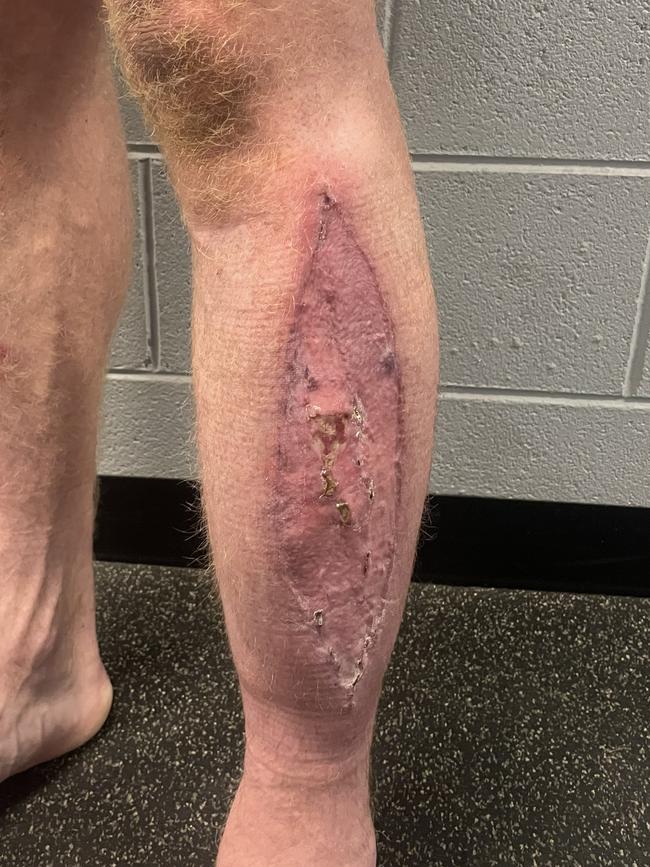 The outside of John Walker's leg.