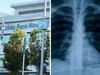 Former hospital staffer files $800k lawsuit over alleged medical breach