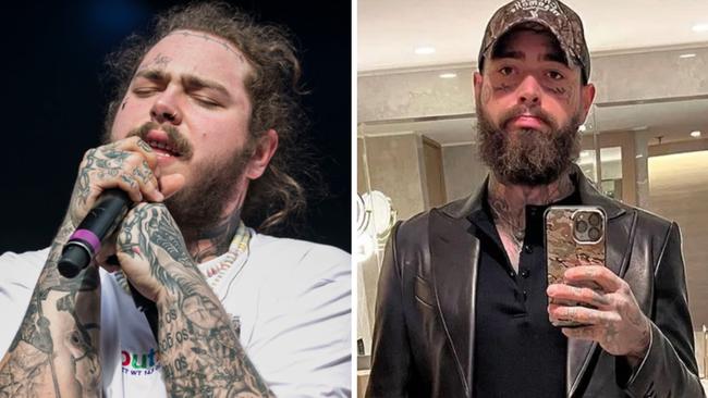 Post Malone has shed a whopping 25kg.