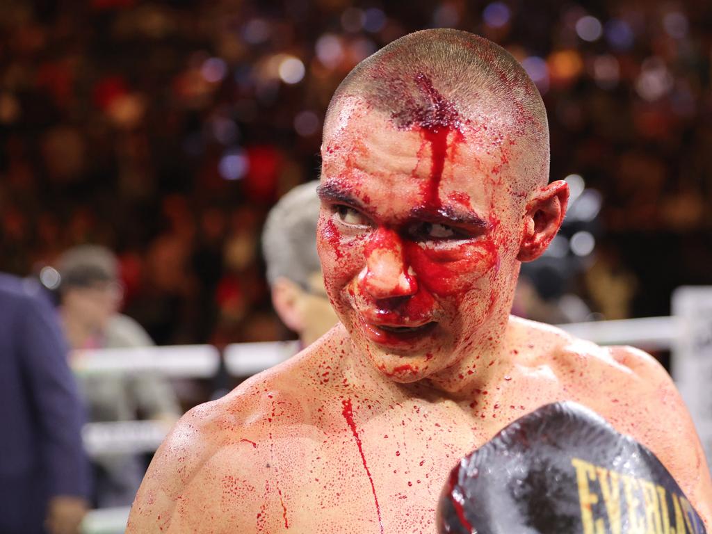 An accidental elbow to the head cut Tszyu early. Picture: Getty Images