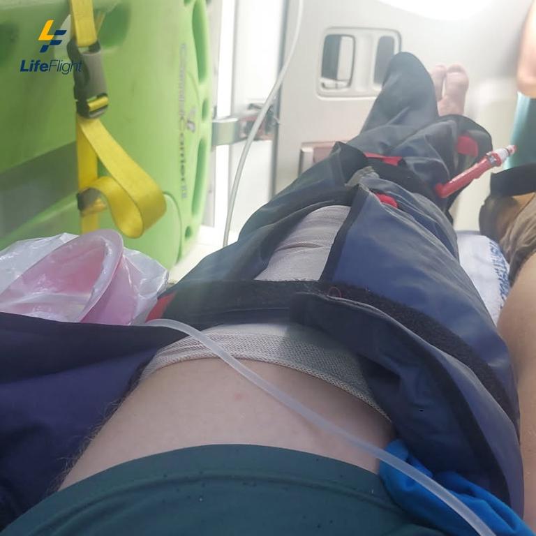 The QAS paramedics bandaged Braydon Brighton's leg and put it in a splint before LifeFlight arrived.