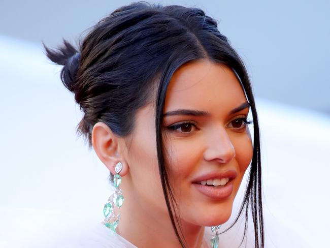 Model Kendall Jenner had Invisalign braces as a teen to help her get her multimillion-dollar smile. Picture: Getty Images