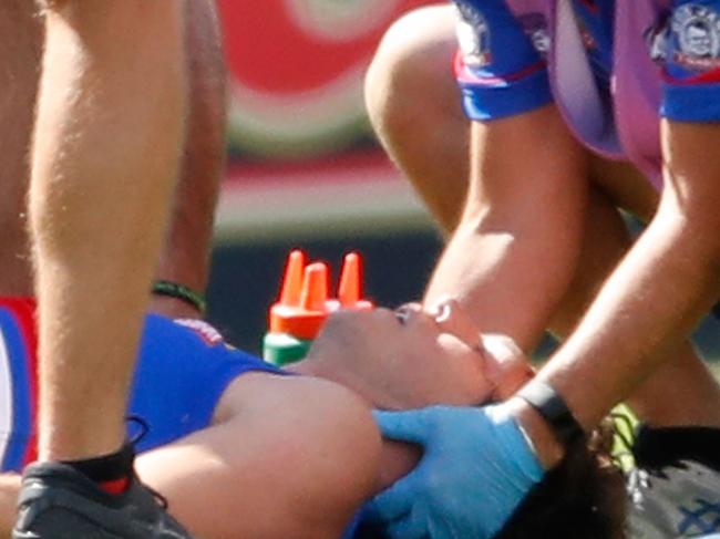 BALLARAT, AUSTRALIA - MARCH 03:  Liam Picken of the Bulldogs lies on the field injured during the AFL JLT Community Series match between the Western Bulldogs and the Hawthorn Hawks at Mars Stadium on March 3, 2018 in Ballarat, Australia.  (Photo by Scott Barbour/Getty Images)