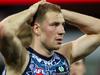 Razor Ray: Flopping won’t ever be eradicated